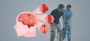 Fisioterapia para reabilitação de funções motoras após um AVC