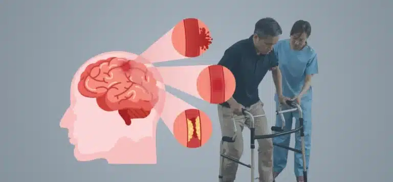 AVC- Fisioterapeuta auxiliando paciente na reabilitação motora após AVC, com ilustração do cérebro e tipos de Acidente Vascular Cerebral ao fundo.