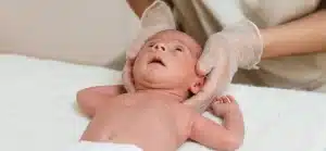 Torcicolo congênito em bebês: tudo sobre o tratamento